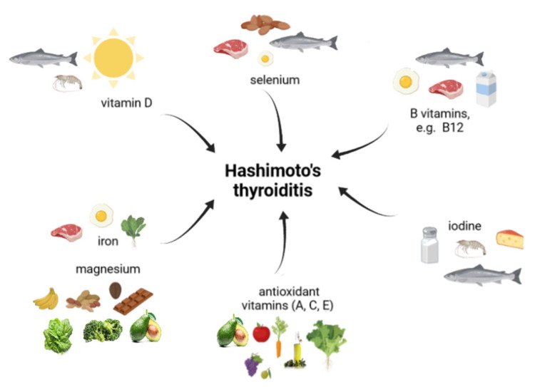 Θυρεοειδίτιδα Χασιμότο (Hashimoto), Αιτίες Εμφάνισης, Συμπτώματα και Διατροφή
